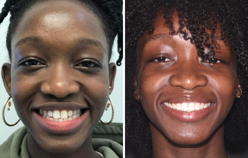 Smile Gallery - Dr. Lena Dentistry